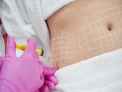 Body Mesotherapy